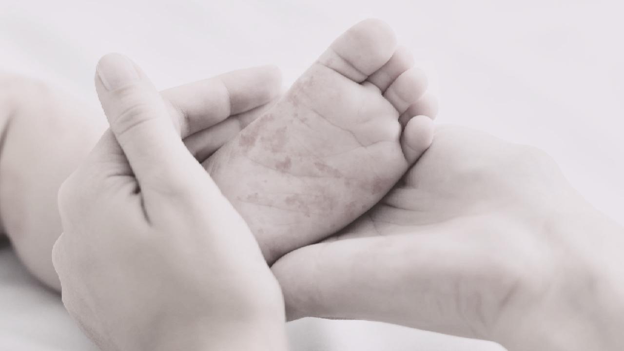 Aumentan a 22 los casos de sarampión en Tomatlán; intensifican medidas de control epidemiológico en la zona