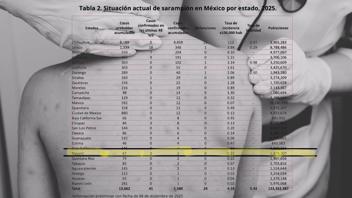 Diferencias en los casos de sarampión en Bahía de Banderas: el Estado señala 1 y la Federación 2
