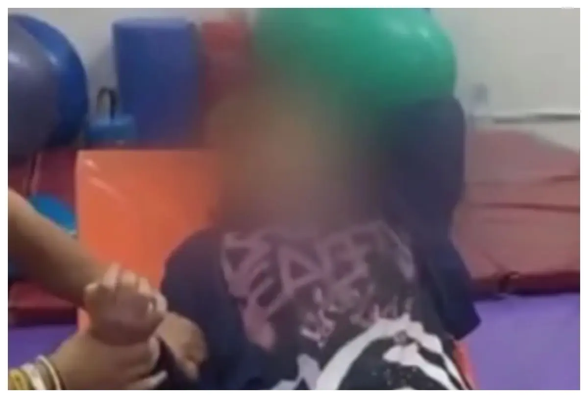 Joven sufre un derrame cerebral tras una rinoplastia en su fiesta de XV años en una clínica de la CDMX