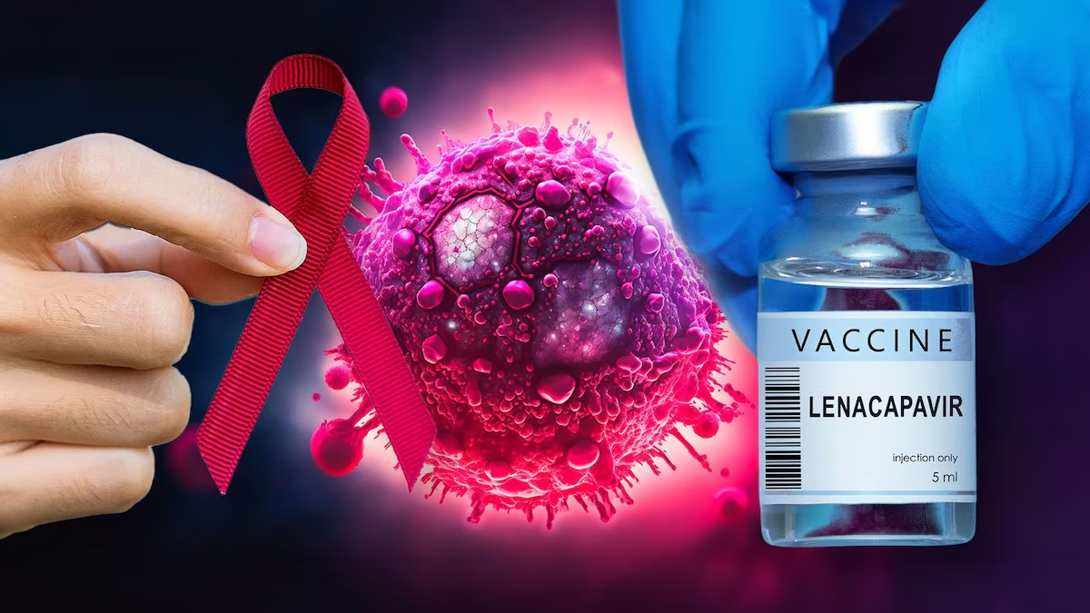 Lenacapavir: una innovadora alternativa en la prevención del VIH sin necesidad de vacuna