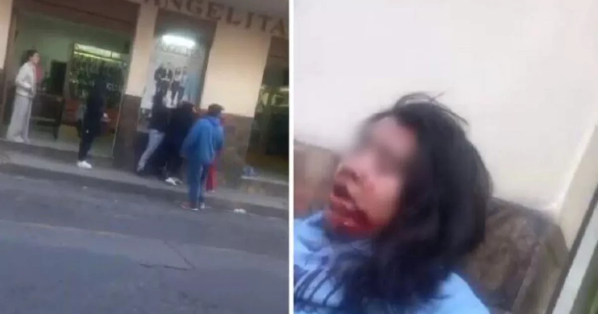 Pelea entre mujeres en Michoacán: ¡una de ellas le arrancó el cachete a mordidas!